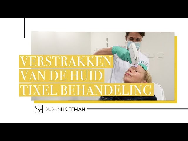 Tixel time voor mijn oogleden
